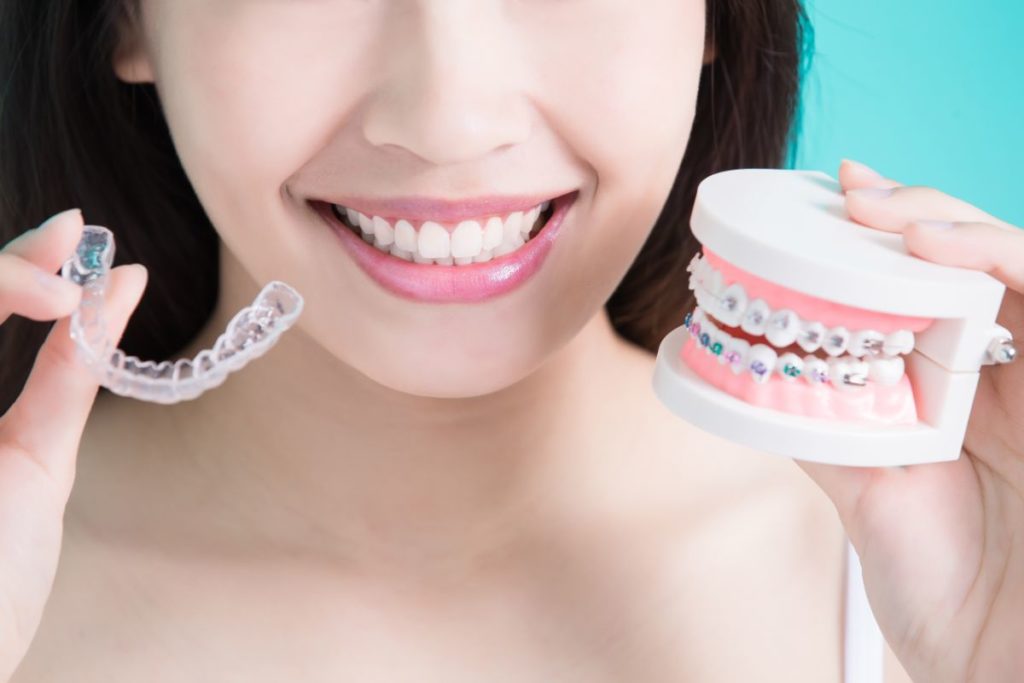 10 Braces Myths You Need to Know