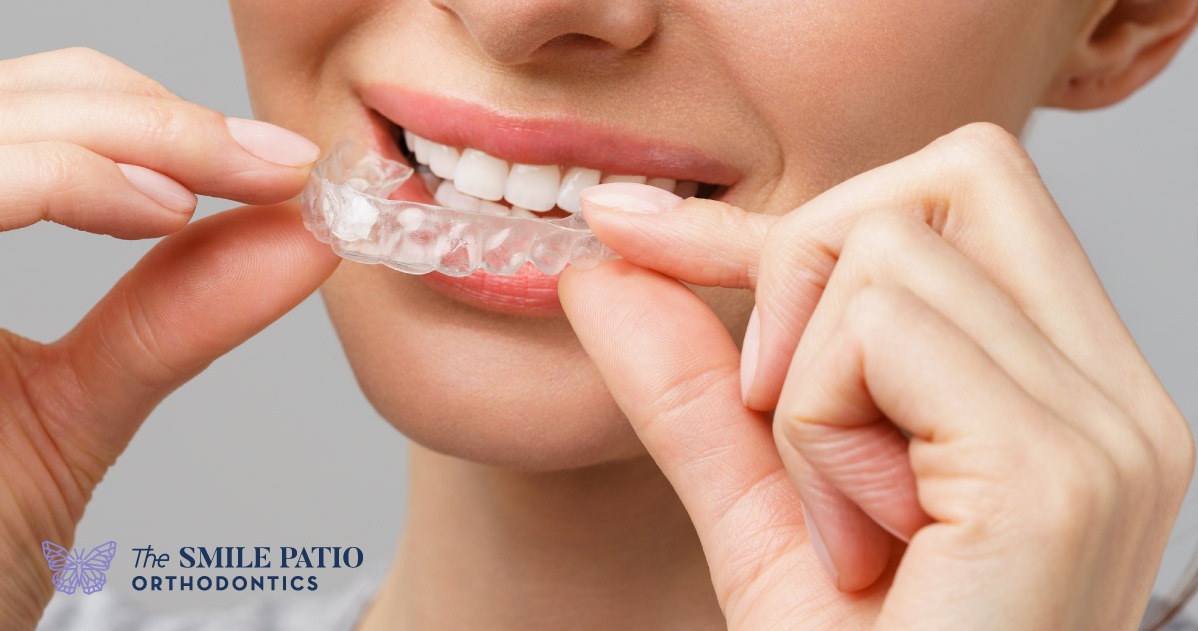 Clear aligners are an effective alternative that can help you fix your smile with discretion and comfort