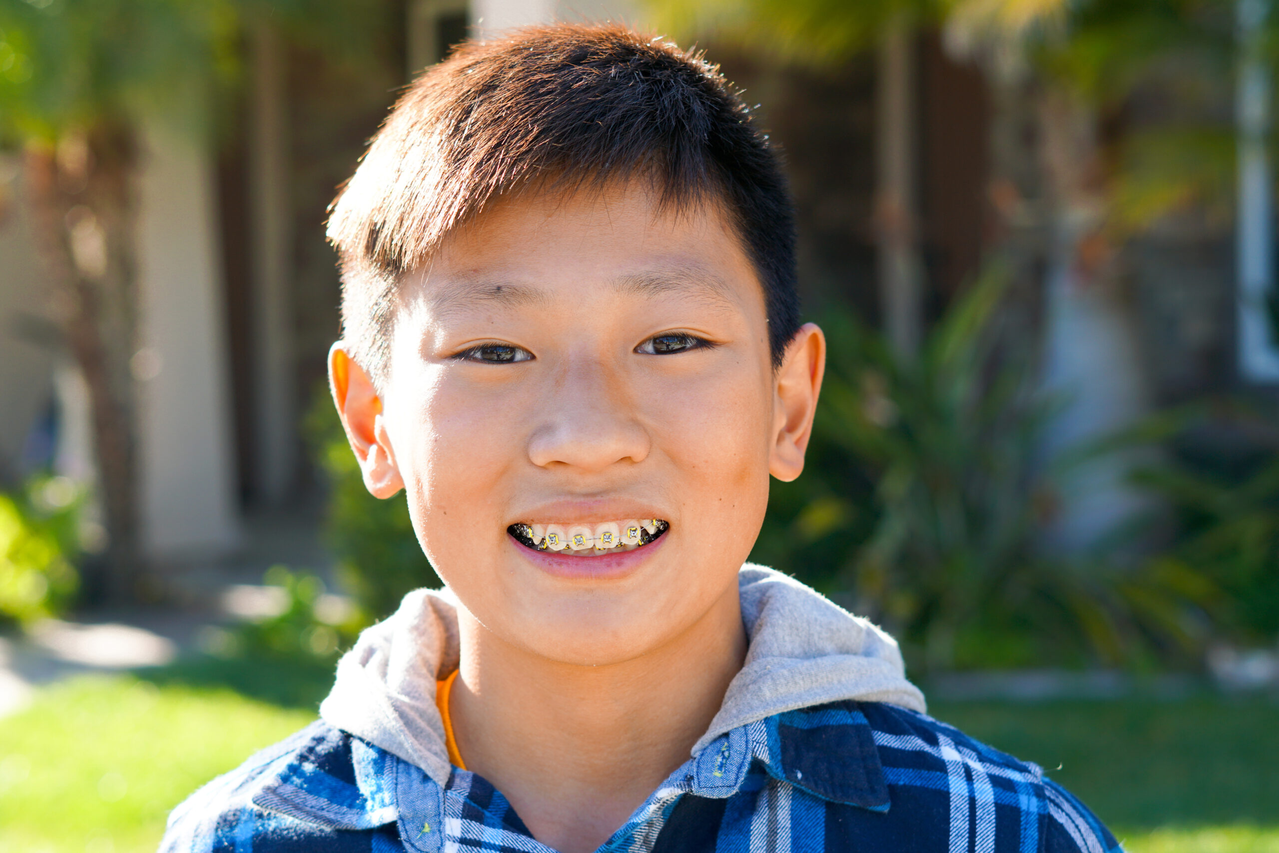 braces orthodontist in vista CA